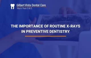 The Importance Of Routine X-Rays In Preventive Dentistry