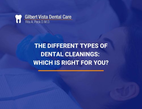 The Different Types Of Dental Cleanings: Which Is Right For You?