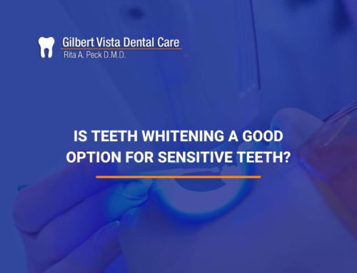 Is Teeth Whitening a Good Option For Sensitive Teeth?
