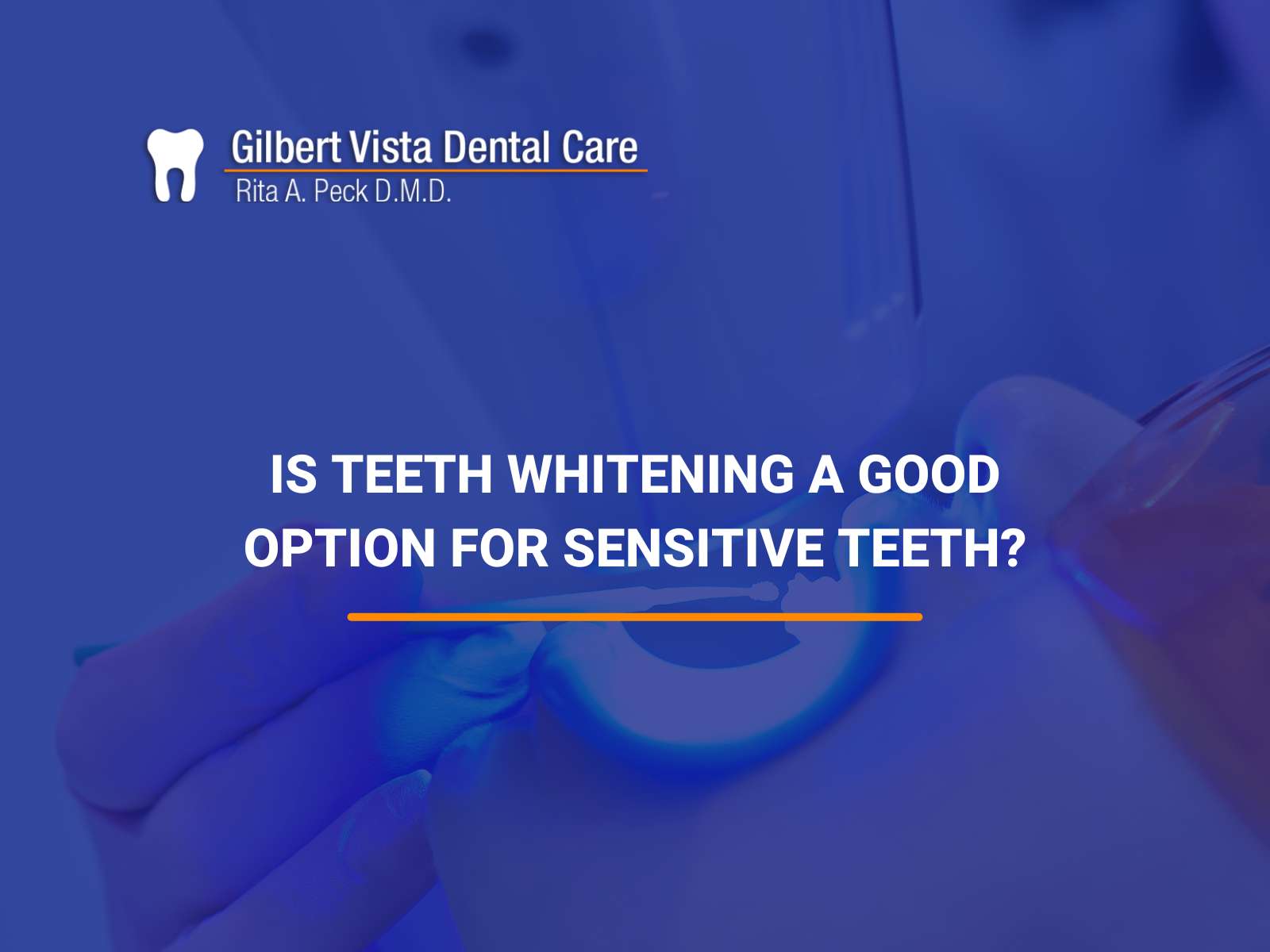 Is Teeth Whitening a Good Option For Sensitive Teeth