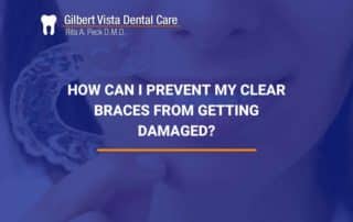 How Can I Prevent My Clear Braces From Getting Damaged