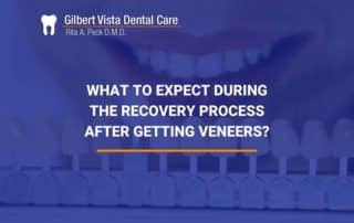 What To Expect During The Recovery Process After Getting Veneers