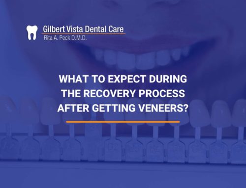 What To Expect During The Recovery Process After Getting Veneers?