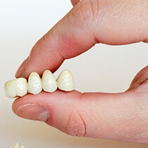 Durable Tooth Crowns for Lasting Protection