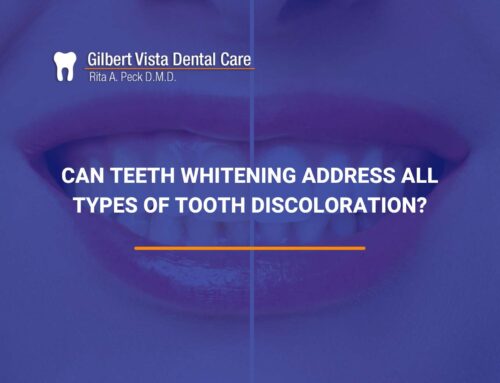 Can Teeth Whitening Address All Types Of Tooth Discoloration?