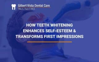 The Psychological Benefits Of Teeth Whitening: How a White Smile Boosts Confidence