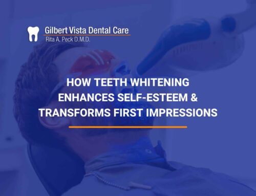 The Psychological Benefits Of Teeth Whitening: How a White Smile Boosts Confidence