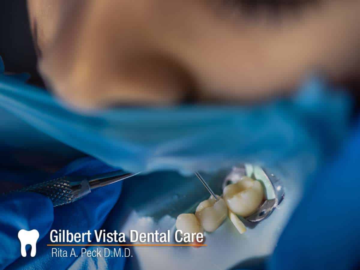 Close-up of a Dental Implants Restoration procedure at Gilbert Vista Dental Care