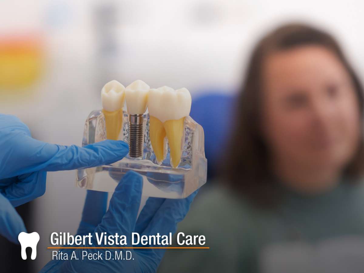 Close-up of a dental professional explaining a dental implant restoration using a model