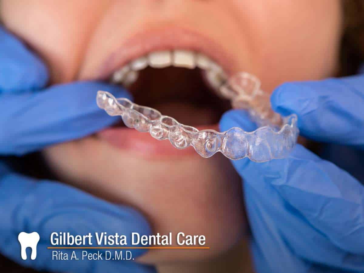 Invisalign aligner fitting at Gilbert Vista Dental Care