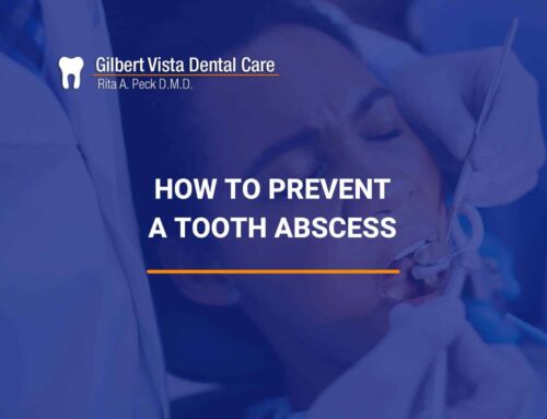 How To Prevent a Tooth Abscess