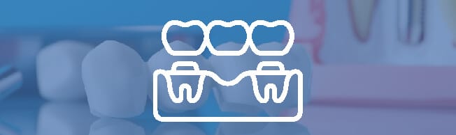 Image of Dental Bridges Being Placed Over Prepared Adjacent Teeth