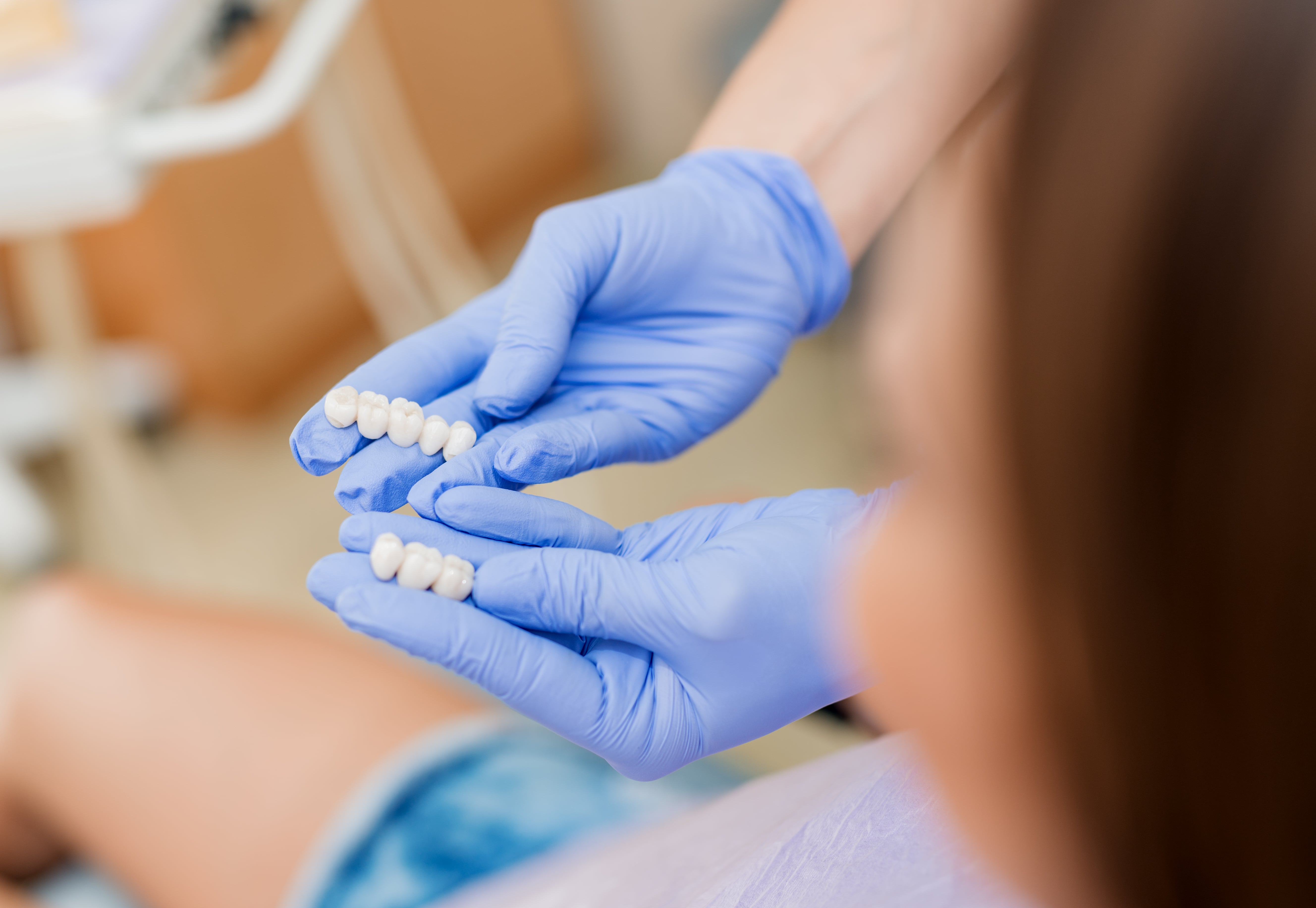 Porcelain Teeth Affordable Dental Crowns and Tooth Caps in Gilbert, AZ