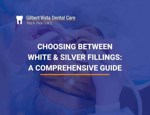 Choosing Between White & Silver Fillings: A Comprehensive Guide